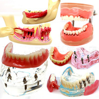 Różne modele zębów dentystycznych są używane do nauczania i materiału dentystycznego szpitala 2